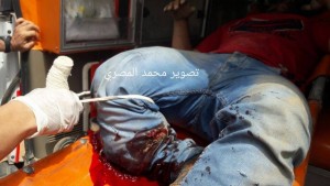 MASSACRE aux yeux du monde6