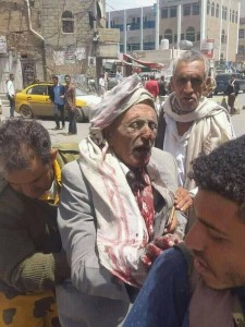 91 martyrs et blessés dans un nouveau massacre de la coalition arabo-US dans la capitale du Yémen3