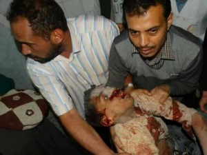 91 martyrs et blessés dans un nouveau massacre de la coalition arabo-US dans la capitale du Yémen5