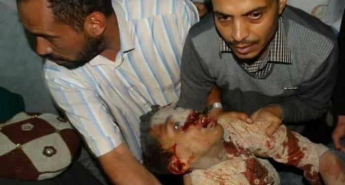 91 martyrs et blessés dans un nouveau massacre de la coalition arabo-US dans la capitale du Yémen