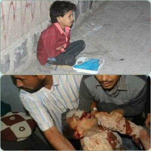 91 martyrs et blessés dans un nouveau massacre de la coalition arabo-US dans la capitale du Yémen9