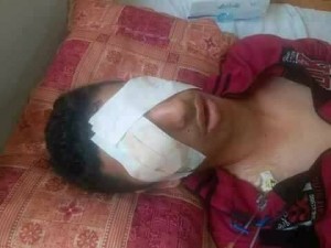 Ahmed Ashour, 17 ans, de Gaza est devenu aveugle après qu'un soldat israélien lui ait tiré dans les yeux2