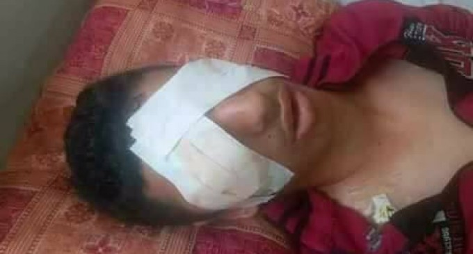 Ahmed Ashour, 17 ans, de Gaza est devenu aveugle après qu’un soldat israélien lui ait tiré dans les yeux