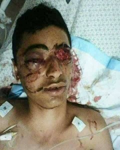 Ahmed Ashour, 17 ans, de Gaza est devenu aveugle après qu'un soldat israélien lui ait tiré dans les yeux3