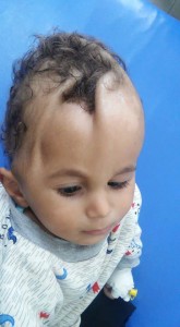 Des enfants yéménites avec des maladies rares causées par le régime saoudien qui bombarde sans cesse le Yémen avec des armes interdites !!!1