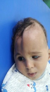 Des enfants yéménites avec des maladies rares causées par le régime saoudien qui bombarde sans cesse le Yémen avec des armes interdites !!!2
