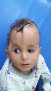 Des enfants yéménites avec des maladies rares causées par le régime saoudien qui bombarde sans cesse le Yémen avec des armes interdites !!!3