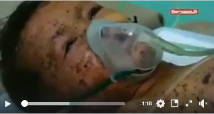 Les États-Unis et le Royaume-Uni ne vendent pas seulement des bombes aux tyrans saoudiens mais les conseillent là où ils doivent frapper !