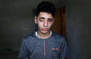 Saleh Ashour, un palestinien de Gaza, 16 ans, a perdu la vue après avoir été pris pour cible par les troupes israéliennes lors des manifestations de la Grande Marche du Retour.1