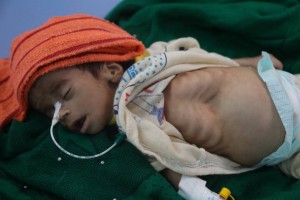 Sans le soutien des gouvernement, l'intervention saoudienne n'aurait pas lieu au Yémen3