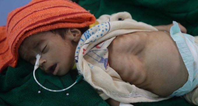 Sans le soutien des gouvernement, l’intervention saoudienne n’aurait pas lieu au Yémen