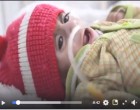 Vidéo : les nourrissons au Yemen font face à une malnutrition sévère, quelques millions d’enfants laissés pour mourir de faim