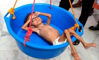 Aujourd&rsquo;hui c&rsquo;est le 28 août 2018, il marque 1 252 jour de la guerre saoudienne sur le Yémen !