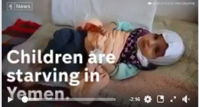 La Coalition dirigée par l&rsquo;Arabie Saoudite est responsable de la malnutrition au Yémen.