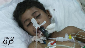 Les hôpitaux locaux de Saada au Nord Yémen sont surpeuplés1