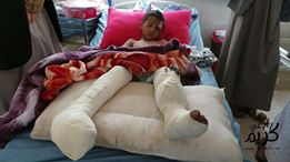 Les hôpitaux locaux de Saada au Nord Yémen sont surpeuplés3