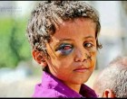 Aux dirigeants du monde : pouvez-vous regarder les yeux du Yémen ?