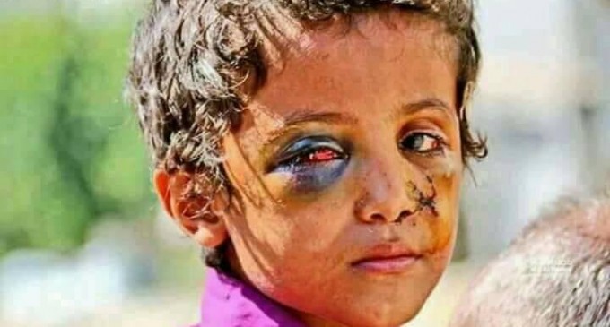 Aux dirigeants du monde : pouvez-vous regarder les yeux du Yémen ?