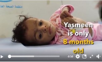 C’est Yasmeen du Yémen. Elle n’a que 8 mois!