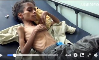 Jusqu’à 85 000 enfants morts de faim ou de maladie au Yémen!