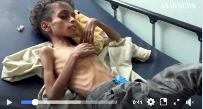 Jusqu&rsquo;à 85 000 enfants morts de faim ou de maladie au Yémen!