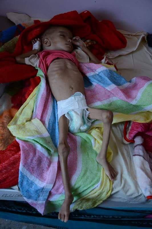 un enfant au Yémen meurt toutes les 10 minutes1