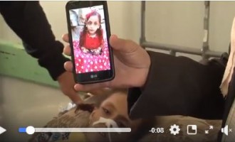 Le nombre d&rsquo;enfants souffrant d&rsquo;une grave malnutrition aiguë au Yémen a augmenté de 90% depuis 2015