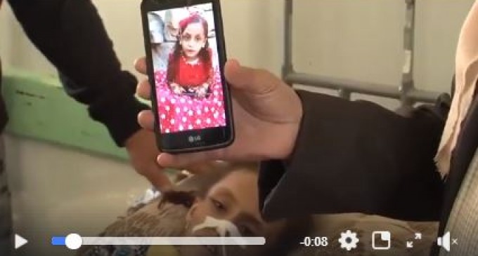 Le nombre d&rsquo;enfants souffrant d&rsquo;une grave malnutrition aiguë au Yémen a augmenté de 90% depuis 2015