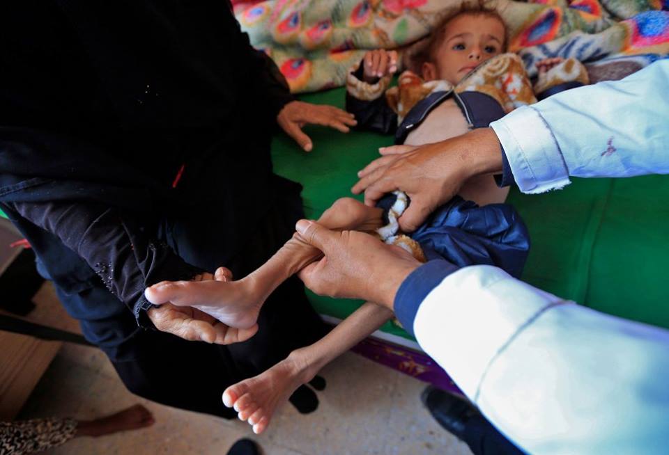 Ne soyons pas indifférents, aidons ces enfants innocents11