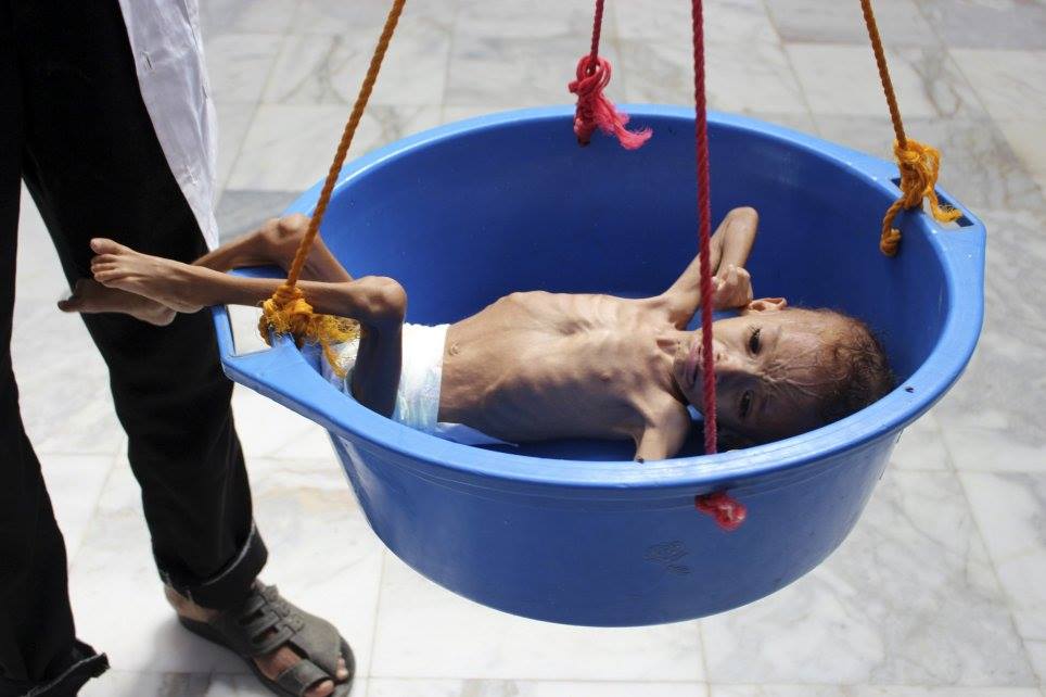 Ne soyons pas indifférents, aidons ces enfants innocents2