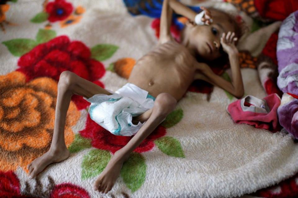 Ne soyons pas indifférents, aidons ces enfants innocents6