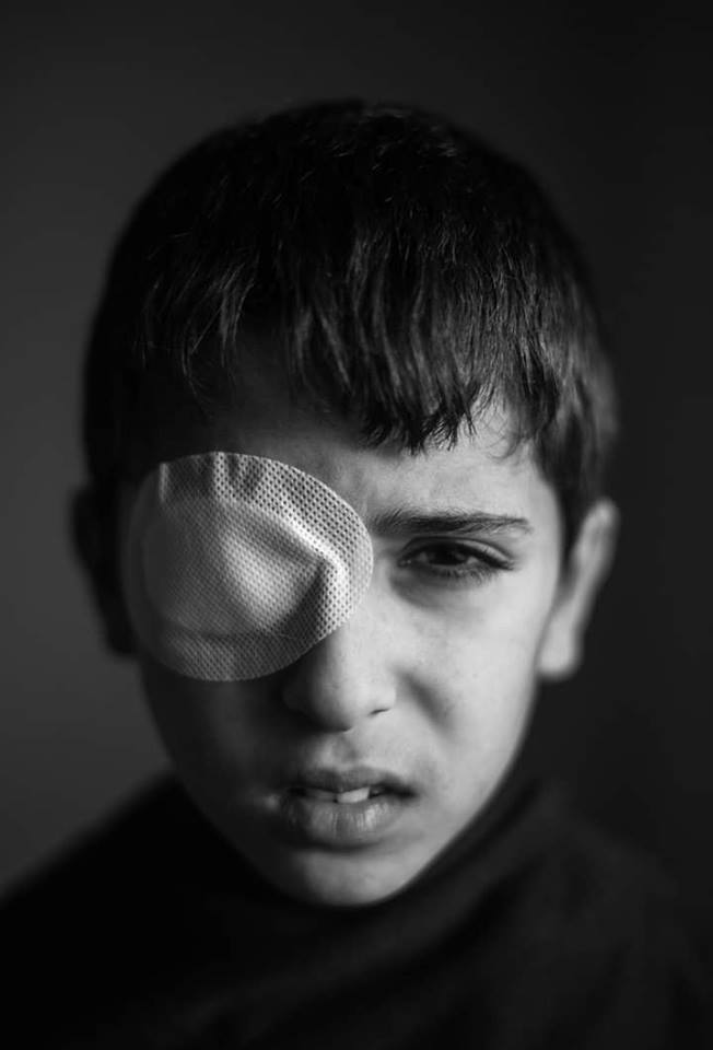 Le jeune Palestinien Mohammed Al-Najjar (12 ans) vit un grave choc psychologique après avoir perdu son œil droit par la balle d'un sniper israélien
