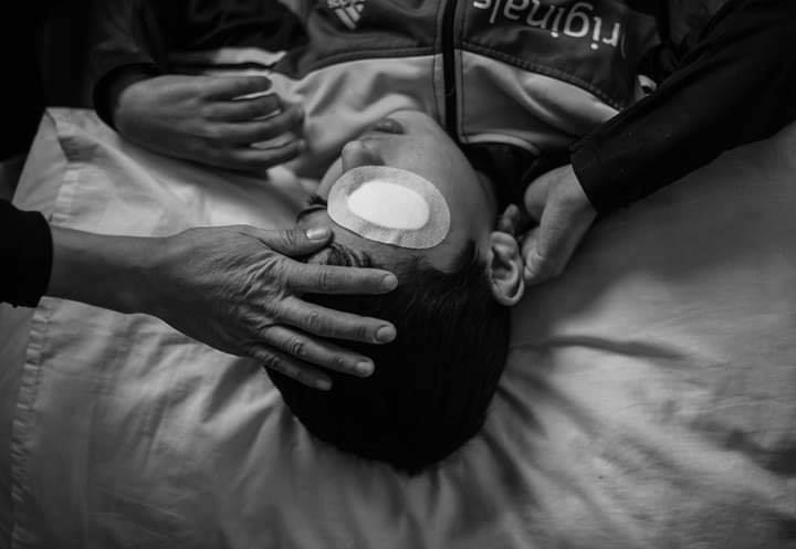 Le jeune Palestinien Mohammed Al-Najjar (12 ans) vit un grave choc psychologique après avoir perdu son œil droit par la balle d'un sniper israélien1