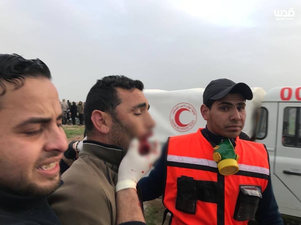 Plusieurs palestiniens ont été blessés par des tireurs d'élite des forces d'occupation vendredi lors des manifestations de la Grande Marche du Retour à Gaza2